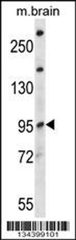 NEDD4L Antibody (Center)