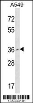 PCGF2 Antibody (Center)