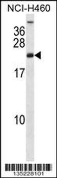 RPS16 Antibody (Center)