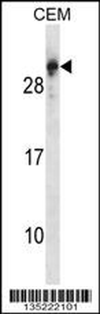 RGS5 Antibody (N-term)