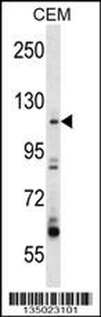 ARHGEF1 Antibody (N-term)