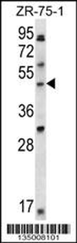 LDB1 Antibody (C-term)