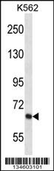 KCND2 Antibody (N-term)
