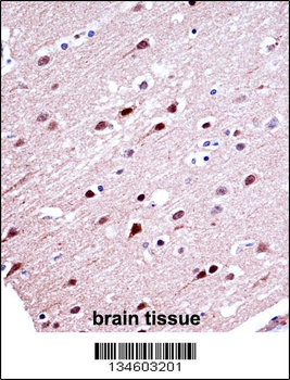 KCND2 Antibody (N-term)