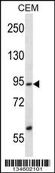 SSRP1 Antibody (C-term)
