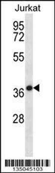 HSPBP1 Antibody (N-term)