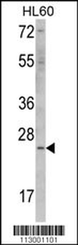 ERAS Antibody (N-term) (F66)