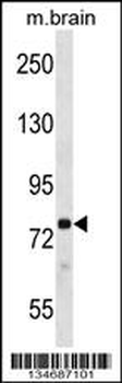 Mouse Prkcb Antibody (N-term)