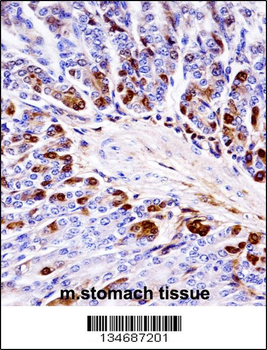 Mouse Prkcb Antibody (N-term)