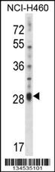IL17D Antibody (C-term)
