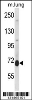 Mouse Prkcd Antibody (N-term)