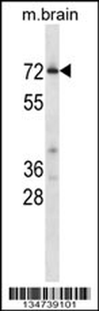 Mouse Cdk17 Antibody (C-term)