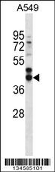 FST Antibody (C-term)