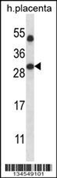 SIRT5 Antibody (Center)