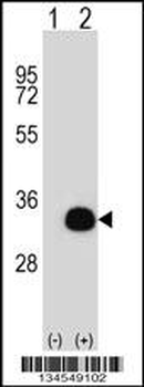 SIRT5 Antibody (Center)