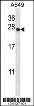 PSMD9 Antibody (C-term)