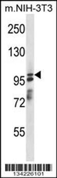 ASAP1 Antibody (Center)