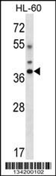 DLX5 Antibody (Center)
