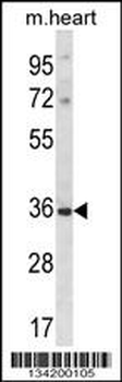 DLX5 Antibody (Center)