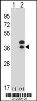 DLX5 Antibody (Center)