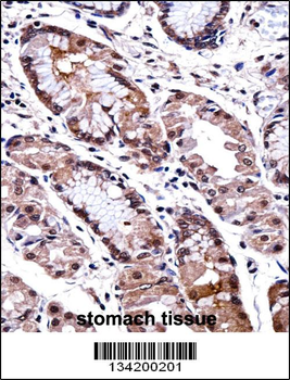 DLX5 Antibody (Center)