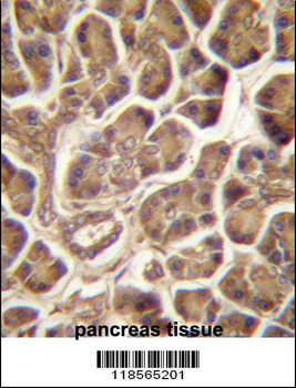 PIPPIN Antibody (Center)
