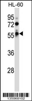 FKRP Antibody (Center)