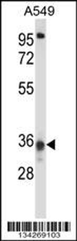 CCDC50 Antibody (Center)
