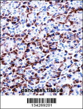 CCDC50 Antibody (Center)