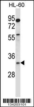 EGLN3 Antibody (C-term)