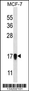 NDUFA13 Antibody (N-term)