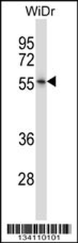 NR2E3 Antibody (Center)