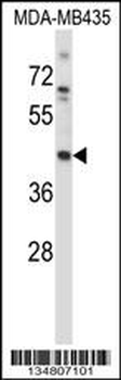 Mouse Map2k1 Antibody (C-term)