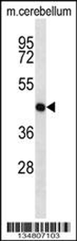 Mouse Map2k1 Antibody (C-term)