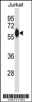 ZAP70 Antibody (N-term)