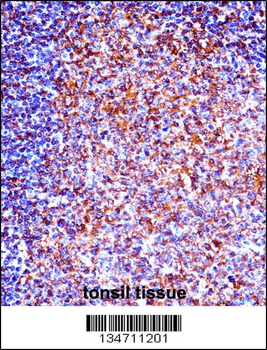 ZAP70 Antibody (N-term)