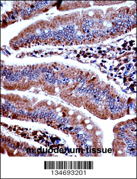 Mouse Prkd3 Antibody (N-term)
