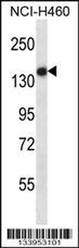 TLR8 Antibody (Center)