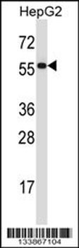 PDIA2 Antibody (Center)