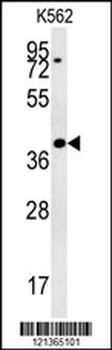 DGCR14 Antibody (Center)