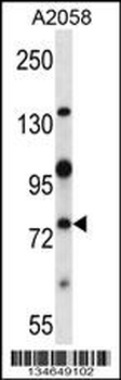 Mouse Nek8 Antibody (C-term)