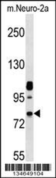 Mouse Nek8 Antibody (C-term)