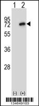 Mouse Nek8 Antibody (C-term)