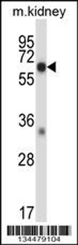 Mouse Map3k2 Antibody (N-term)