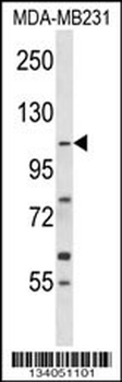 COPB1 Antibody (Center)