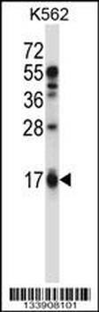 EDN2 Antibody (C-term)