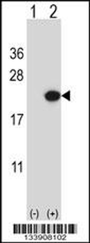 EDN2 Antibody (C-term)