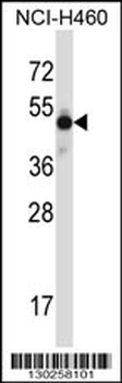 MKX Antibody (N-term)
