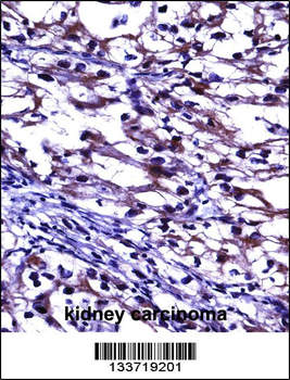TNFRSF11B Antibody (Center)