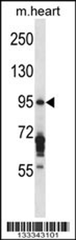 EXOC6B Antibody (C-term)